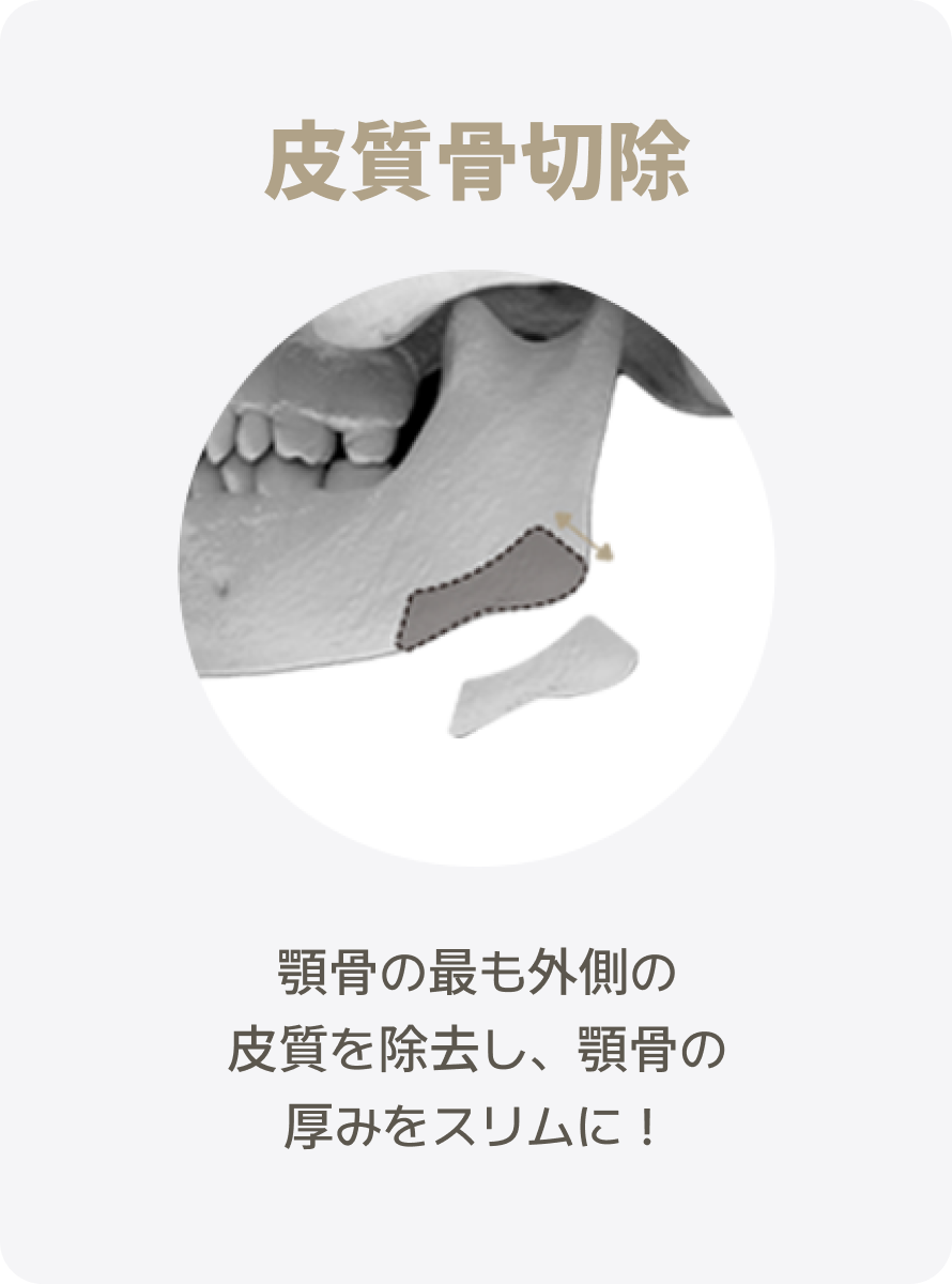 Frame 1707483528